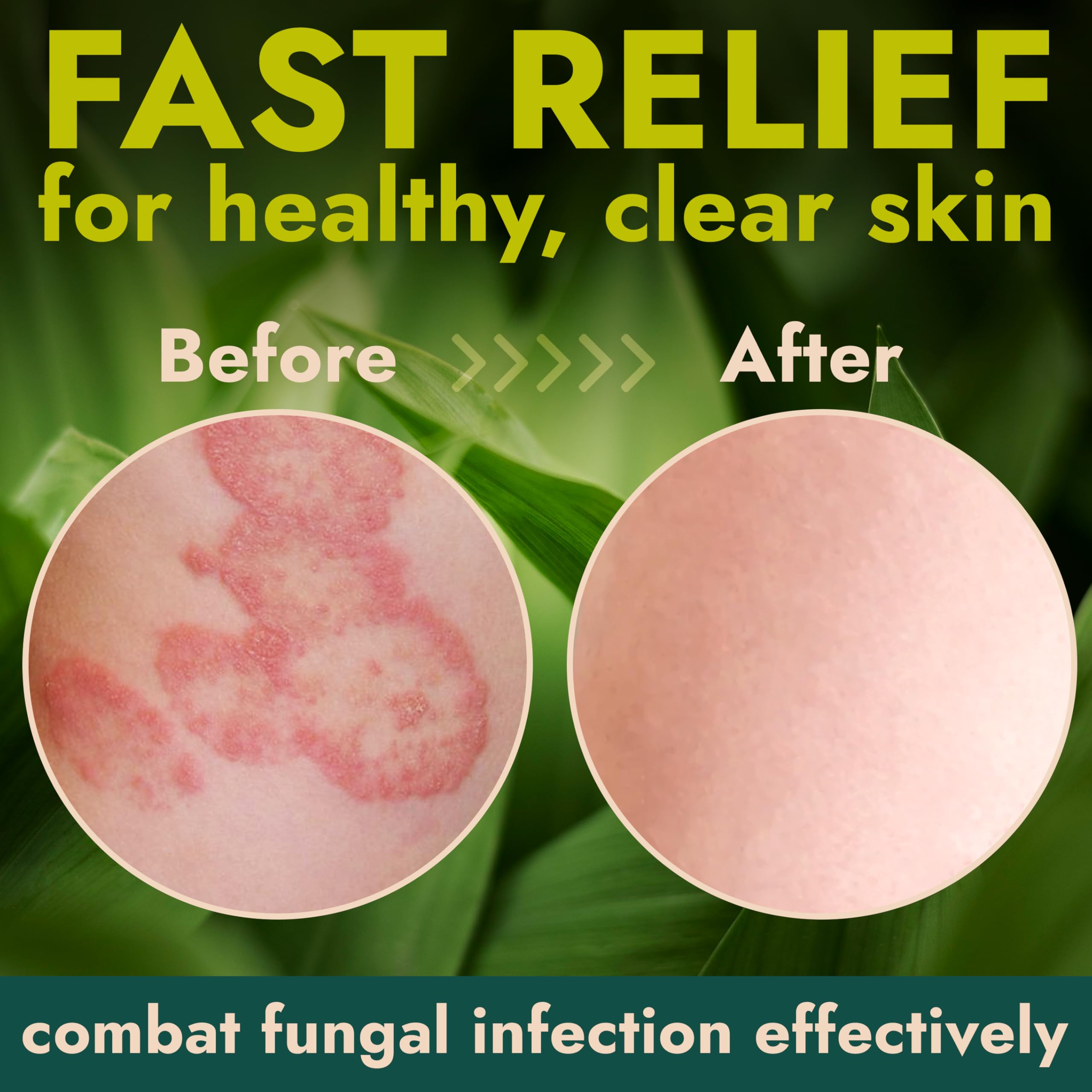 Antifungal Cream | Body Cream for Jock Itch, Ringworm & Athletes Foot | Strength Formula with Tea Tree Oil | Helps With Itching,
