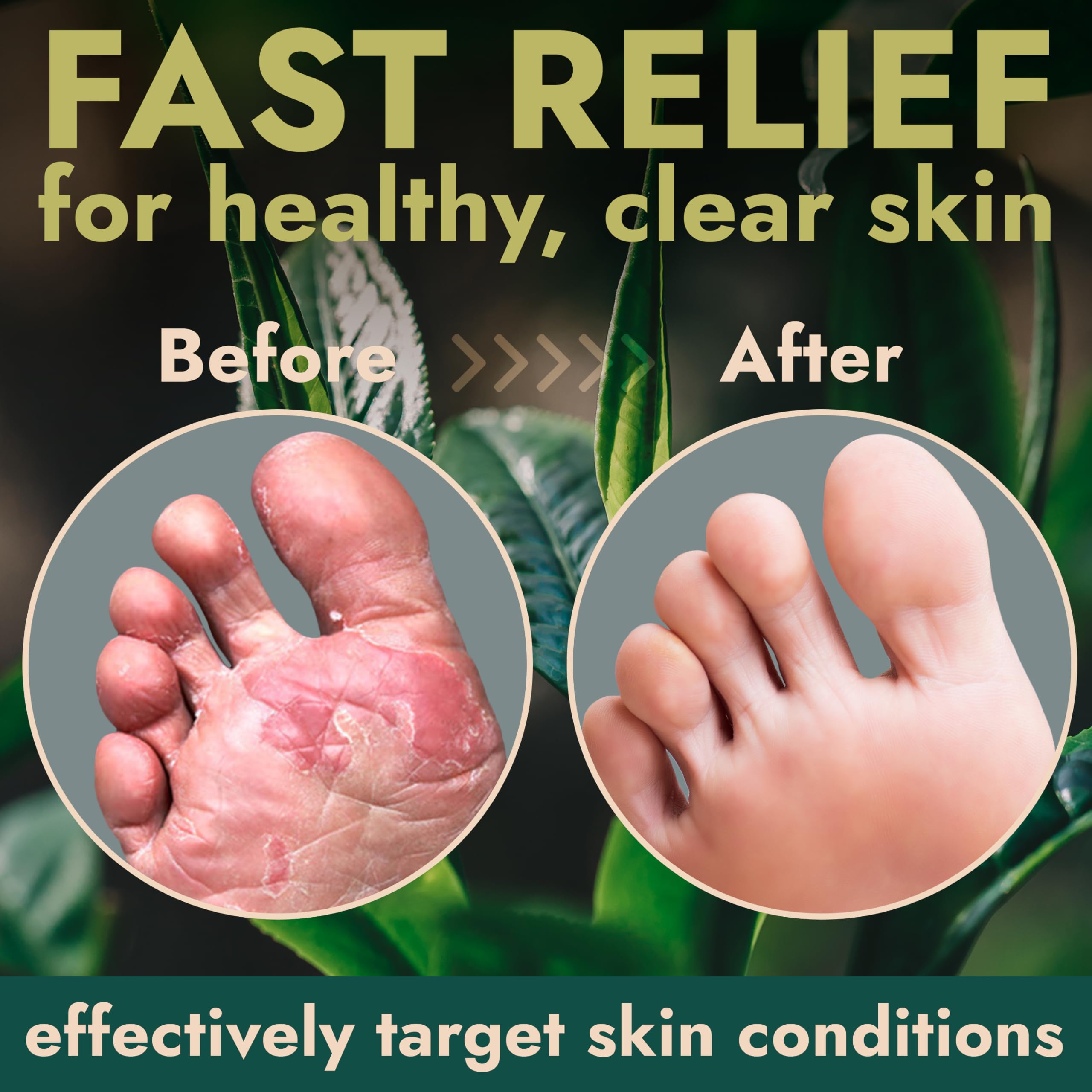 Terramed Just Think Comfort Foot Spray with Tea Tree Oil | Antifungal Treatment for Jock Itch, Nail Fungus & Ringworm | Fast Abs
