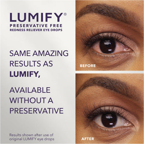 LUMIFY Preservative Free Redness Reliever Eye Drops, 20 Single Use Vials, Fast Acting, Only PF Drop for Whiter & Brighter Lookin