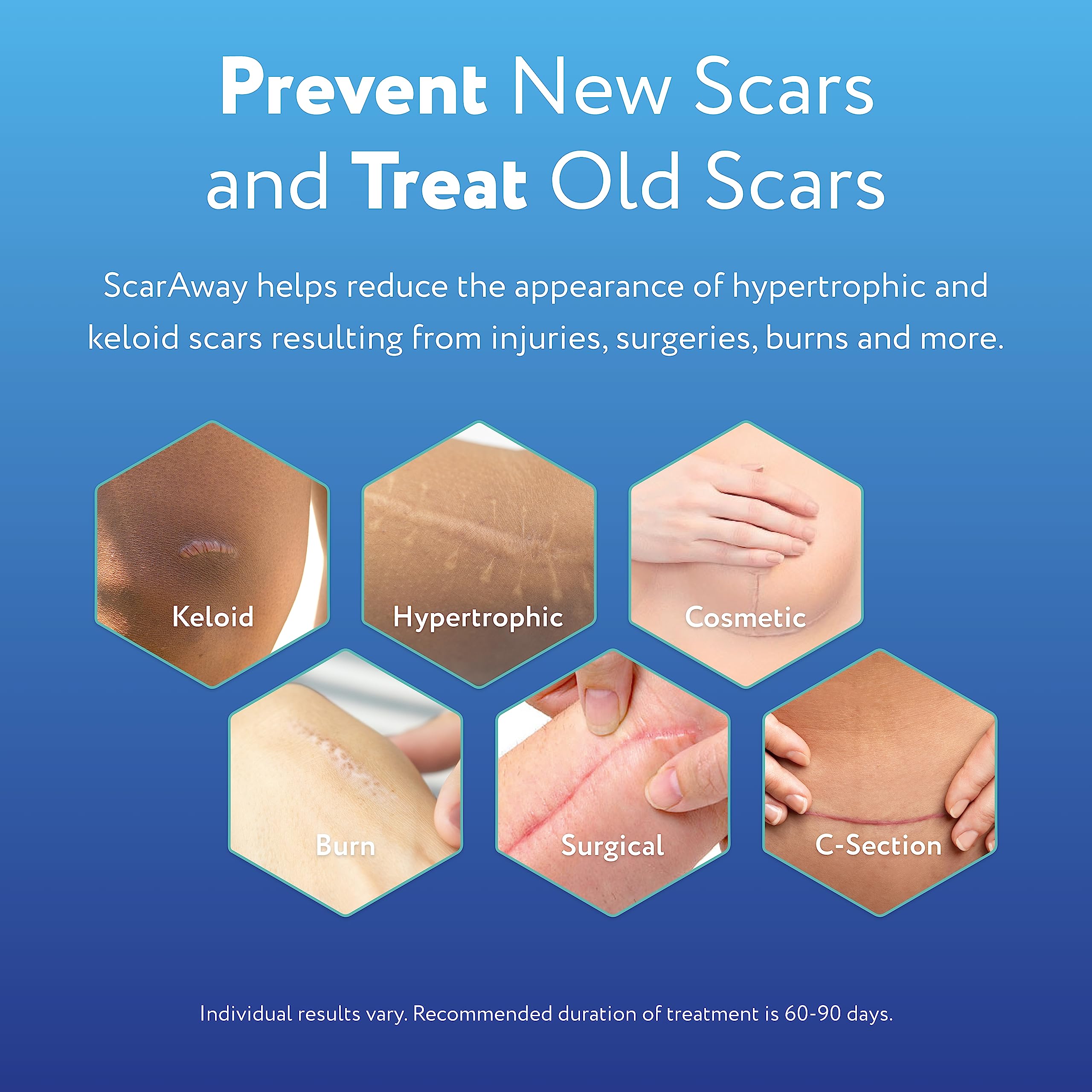 ScarAway Clear Silicone Scar Sheets, White, 10 Count