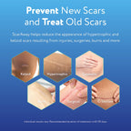 ScarAway Clear Silicone Scar Sheets, White, 10 Count