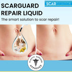 Scarguard - Invisible Brush-On Silicone Sheet with Vitamin E - Scar Removal for Keloids, Burn Scars, Surgery Scars, Stitches, Cu