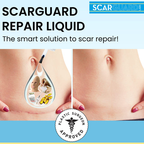 Scarguard - Invisible Brush-On Silicone Sheet with Vitamin E - Scar Removal for Keloids, Burn Scars, Surgery Scars, Stitches, Cu