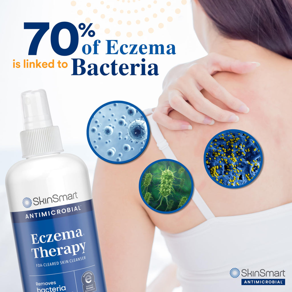 SkinSmart Antimicrobial Eczema Therapy with Hypochlorous Acid, Removes Bacteria so Skin Can Heal, for Adults, Kids and Seniors,