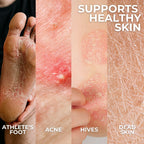 Toe Juice Skin Relief & Recovery Topical Plant-Based Treatment - Body, Face, Toe & Finger Nails - Fungal Acne, Athletes Foot & F