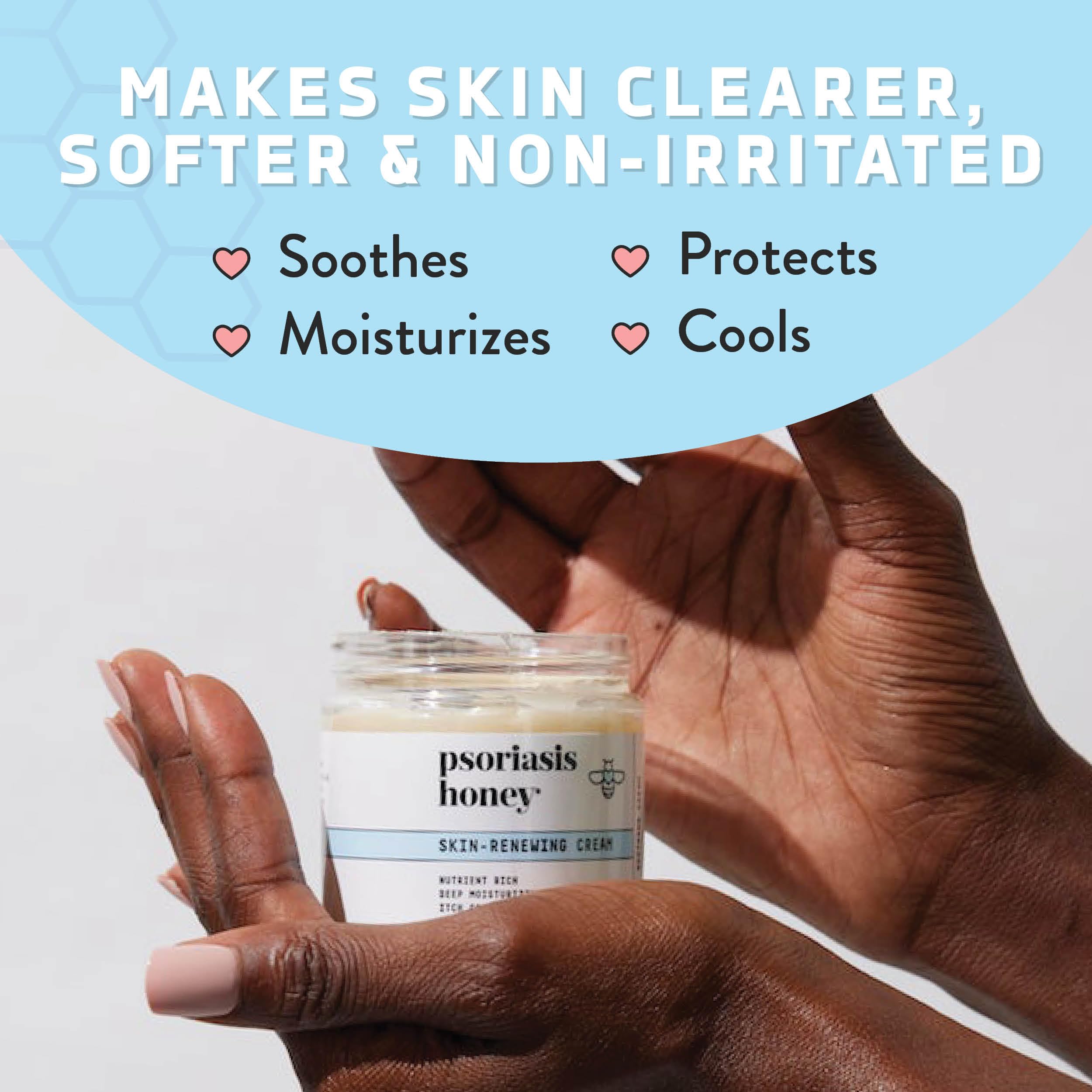 PSORIASIS HONEY Skin-Renewing Cream - Eczema & Seborrheic Dermatitis Cream - Psoriasis Treatment for Skin, Redness & Itch Relief