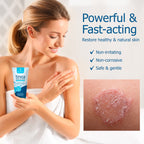 Roycederm Tinea Versicolor Treatment, Athletes Foot Treatment, Ringworm Treatment For humans, Antifungal Cream for Tinea Versico