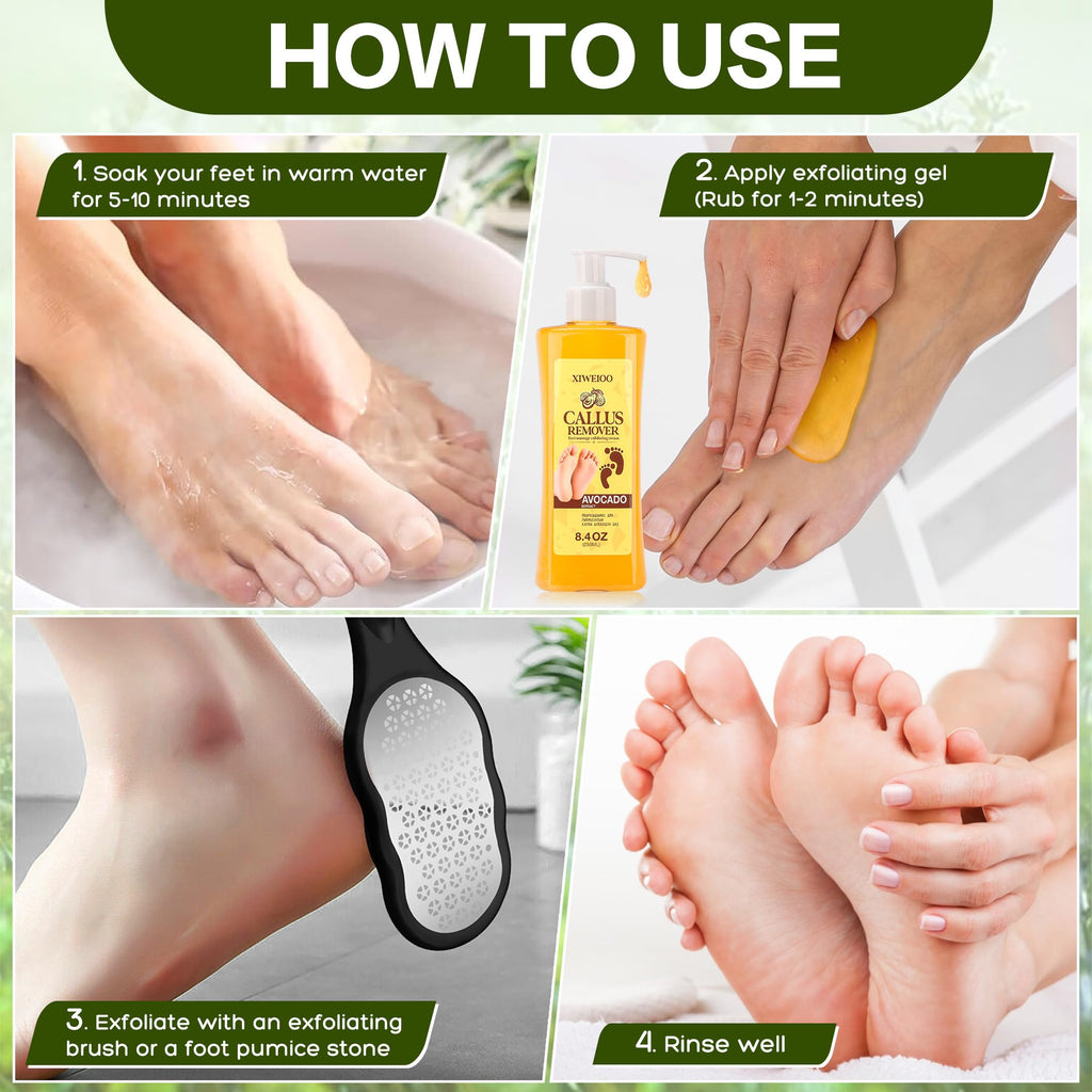 XIWEIOO Foot Callus Remover Gel Kit Heel Exfoliator Dead Skin Remover Pedicure Foot Spa Products Set Home Pedicure Foot Care Spa