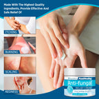 Roycederm Antifungal Cream, Athletes Foot Treatment Cream, Jock Itch Cream, Antifungal Treatment for Athletes Foot, Eczema, Psor