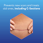 ScarAway Advanced Silicone Scar Sheets for C-Section, Reusable Sheets (1.5    x 7   ) for Hypertrophic and Keloid Scars from C-S
