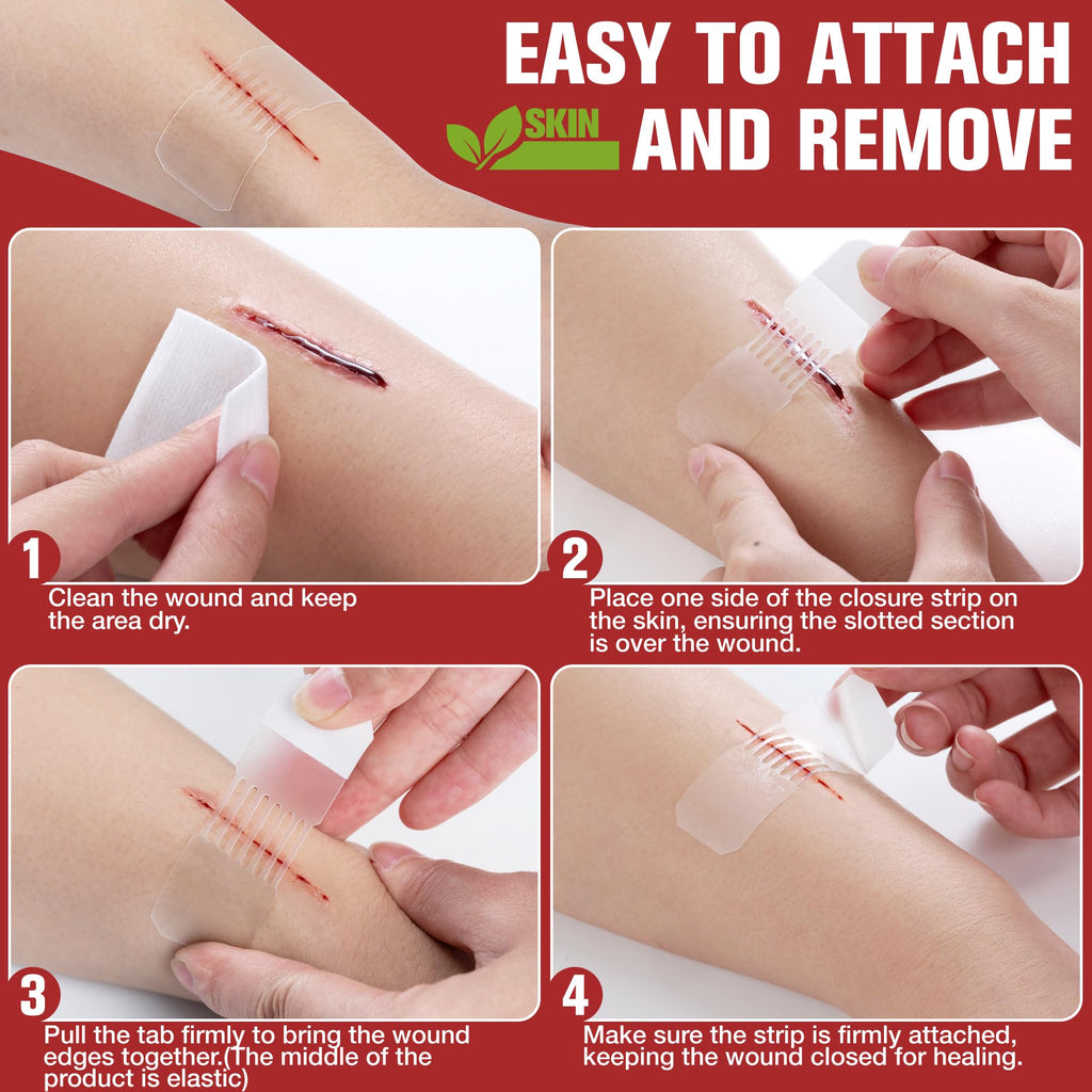 Emergency Wound Closure Strips - FSA/HSA Eligible - Dotodo 2PCS Laceration Closure Kit - Sutures Butterfly Bandaids | Stretchabl