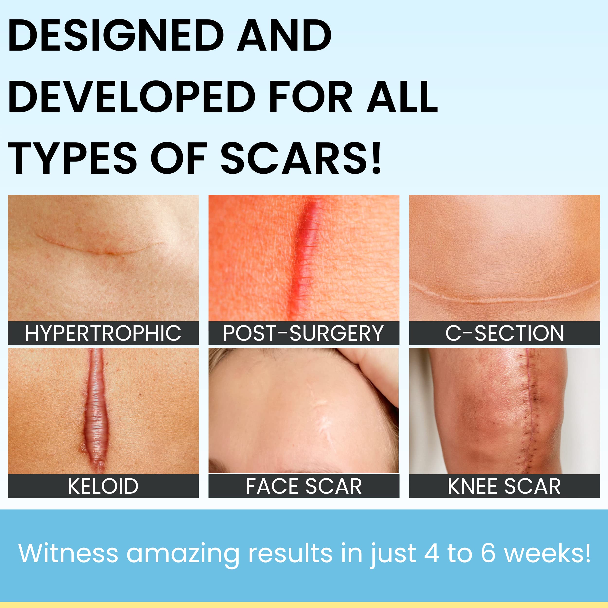 Scarguard - Invisible Brush-On Silicone Sheet with Vitamin E - Scar Removal for Keloids, Burn Scars, Surgery Scars, Stitches, Cu