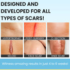 Scarguard - Invisible Brush-On Silicone Sheet with Vitamin E - Scar Removal for Keloids, Burn Scars, Surgery Scars, Stitches, Cu