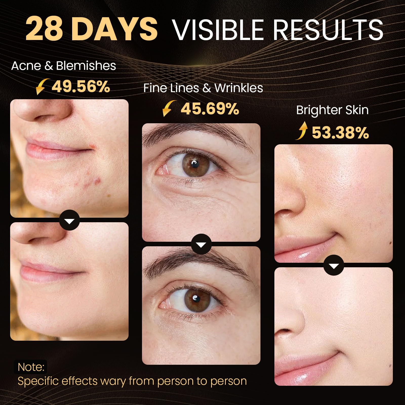 Lovsheme Red Light Therapy for Face, Enhance LED Face Mask Light Therapy for Acne, Wrinkles & Skin Rejuvenation, 3 Light Modes &