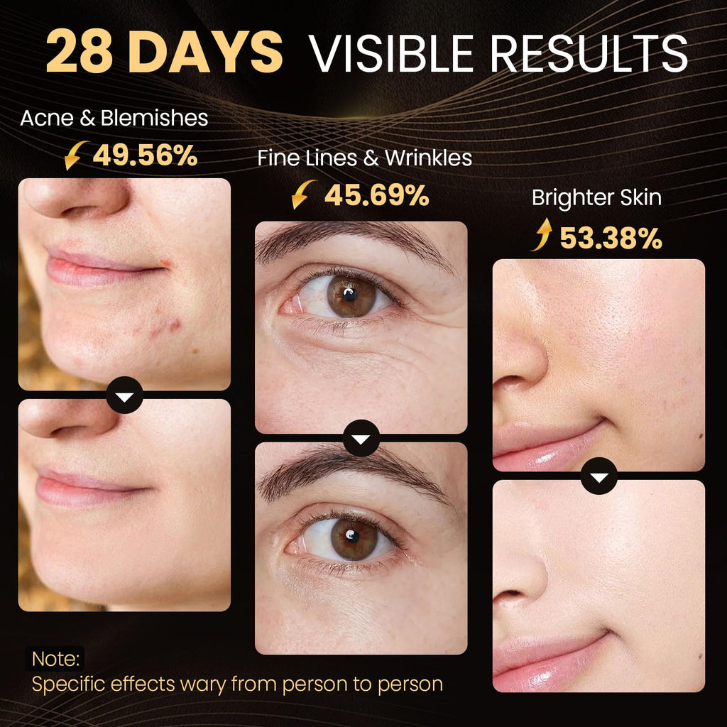 Lovsheme Red Light Therapy for Face, Enhance LED Face Mask Light Therapy for Acne, Wrinkles & Skin Rejuvenation, 3 Light Modes &