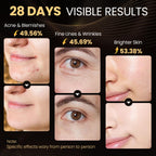 Lovsheme Red Light Therapy for Face, Enhance LED Face Mask Light Therapy for Acne, Wrinkles & Skin Rejuvenation, 3 Light Modes &