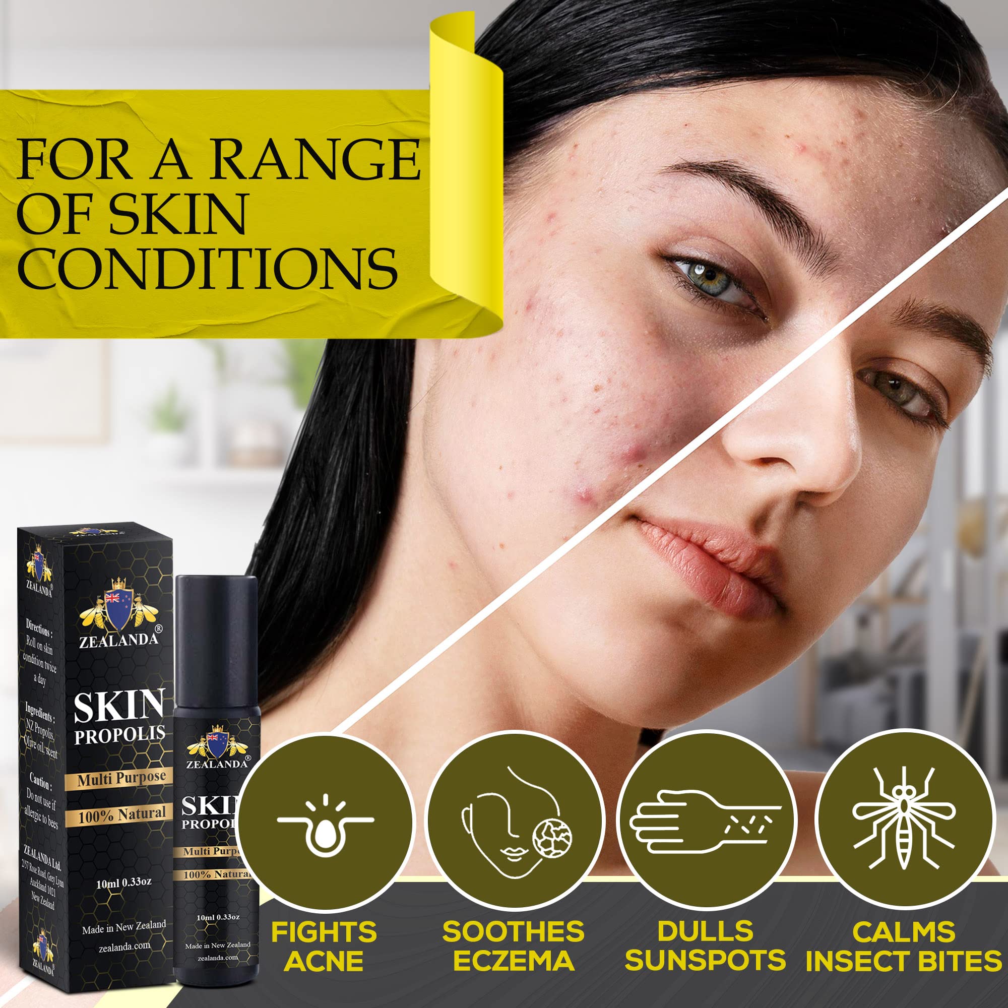 ZEALANDA Skin Propolis, Multi Purpose 100% Natural, Alcohol-Free for Acne, Pimple, Eczema, Callus, Sunspot,Skin Rash, Insect Bit