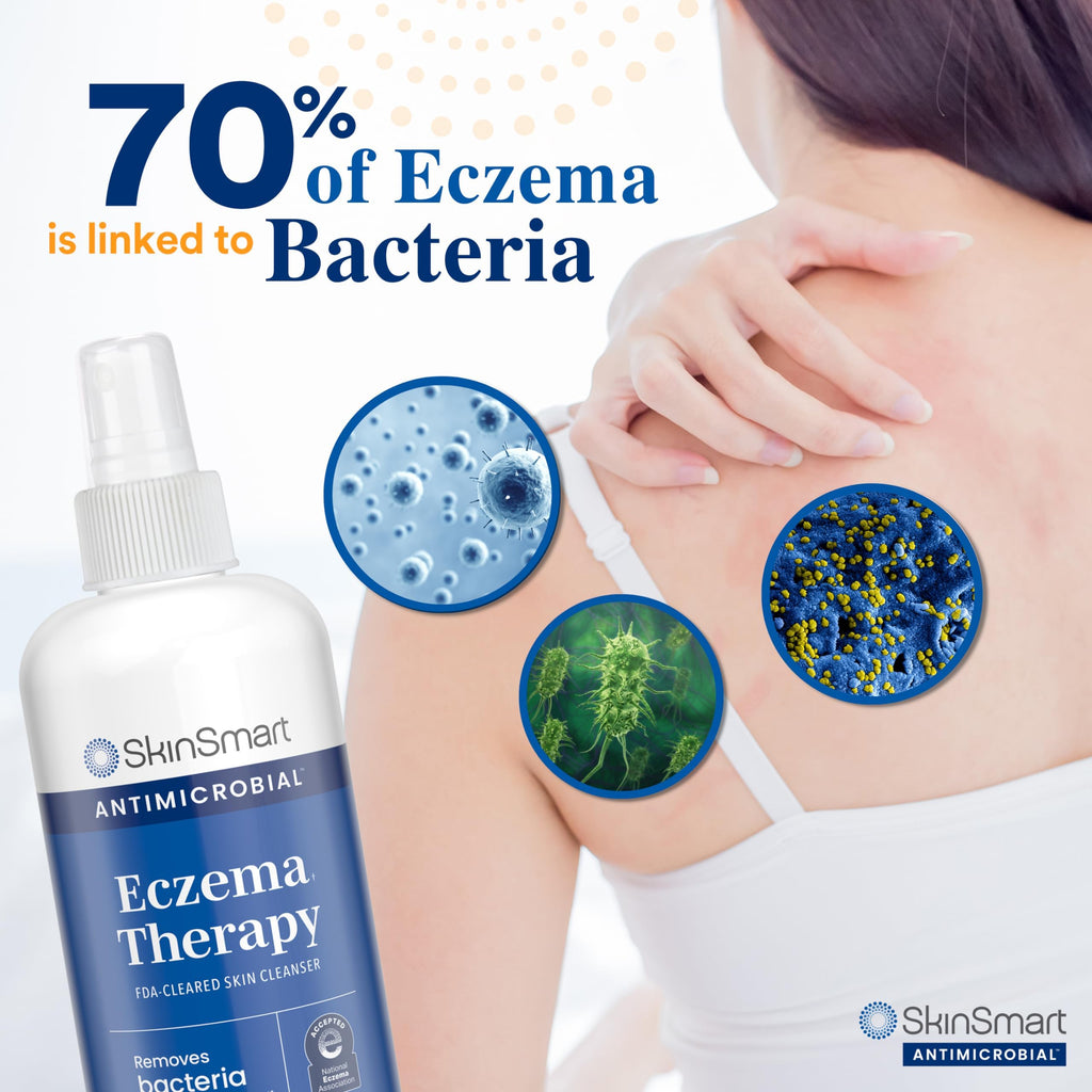 SkinSmart Eczema Therapy, Hypochlorous Antimicrobial Safely Removes Bacteria, so Your Skin Can Heal, Travel Size 2 Ounce Spray (