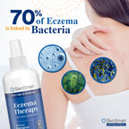 SkinSmart Eczema Therapy, Hypochlorous Antimicrobial Safely Removes Bacteria, so Your Skin Can Heal, Travel Size 2 Ounce Spray (