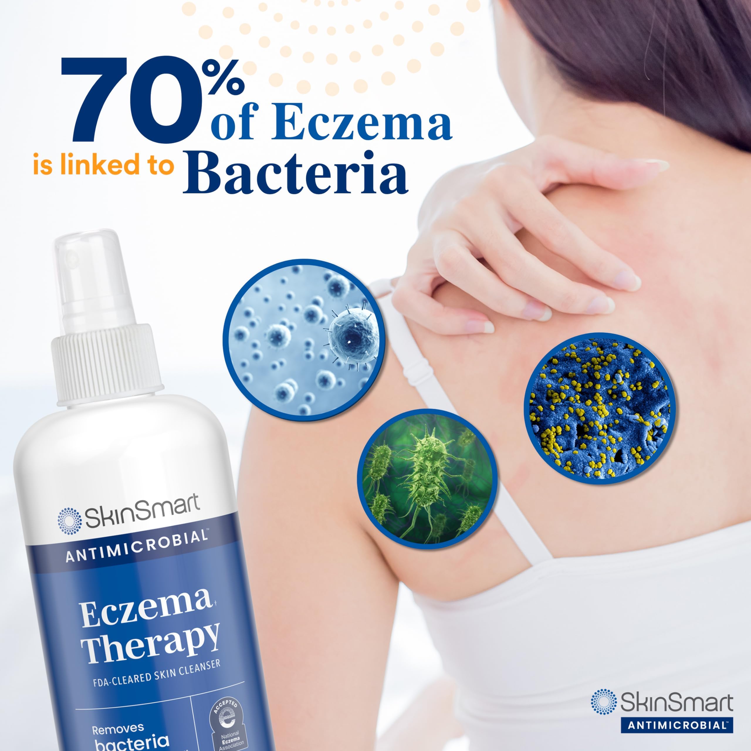 SkinSmart Eczema Therapy, Hypochlorous Antimicrobial Safely Removes Bacteria, so Your Skin Can Heal, Travel Size 2 Ounce Spray (