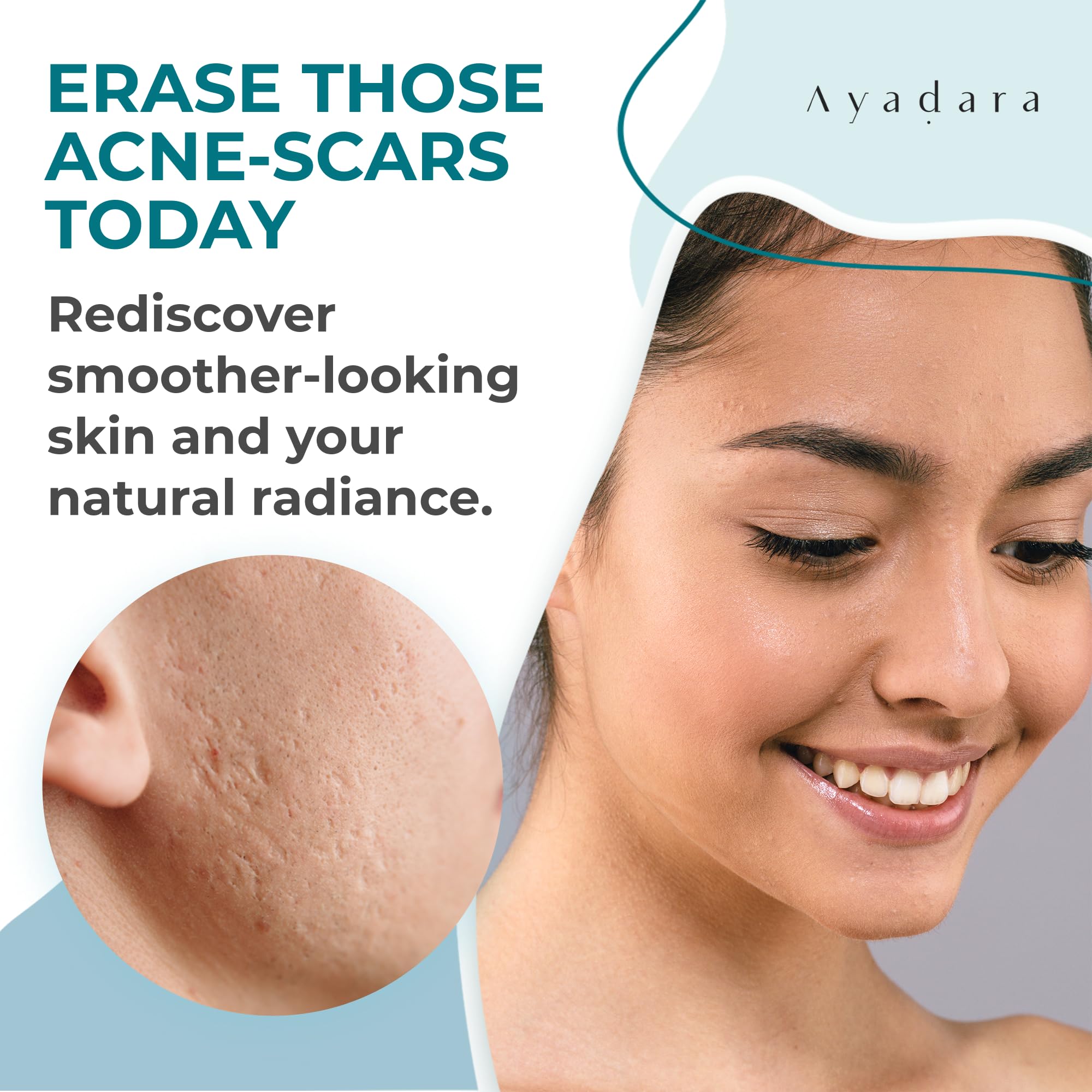 Ayadara Acne Scar Healing Cream, 2 fl oz, Acne Scar Treatment for Face, Stretch Marks, Body Scars, Acne Scar Removal Cream for B