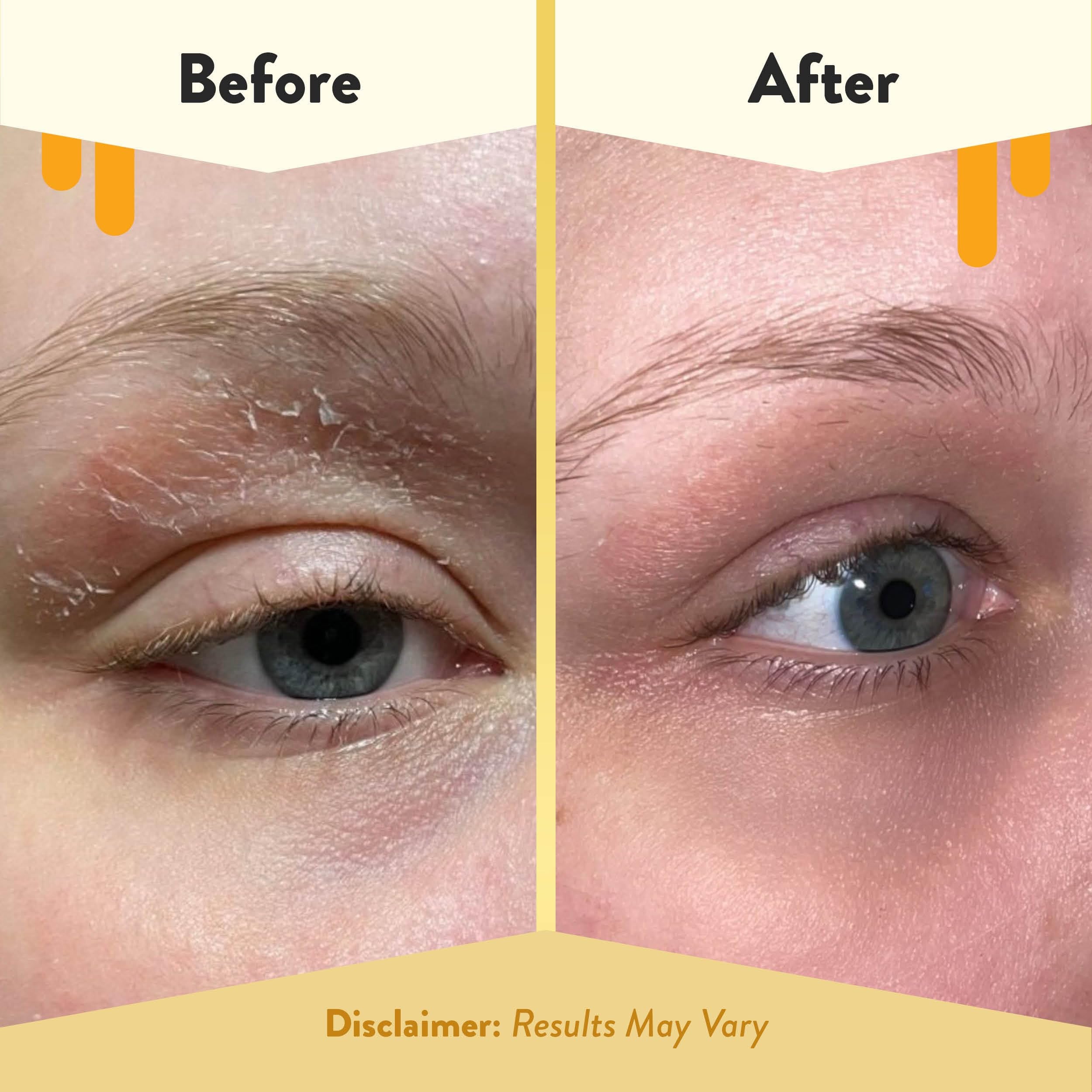 ECZEMA HONEY Multi Peptide Eye Cream - Anti Aging Eye Cream for Dark Circles & Puffiness - Facial Skin Care Products for Eczema,