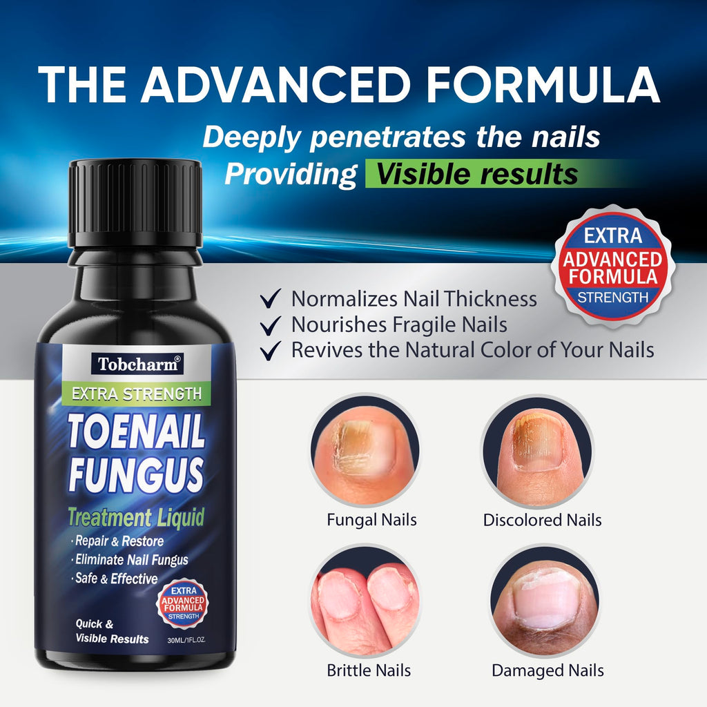 Tobcharm Toenail Fungus Treatment Extra Strength, Nail Fungus Treatment for Toenail, Fungus Nail Treatment, Nail Fungus Treatmen