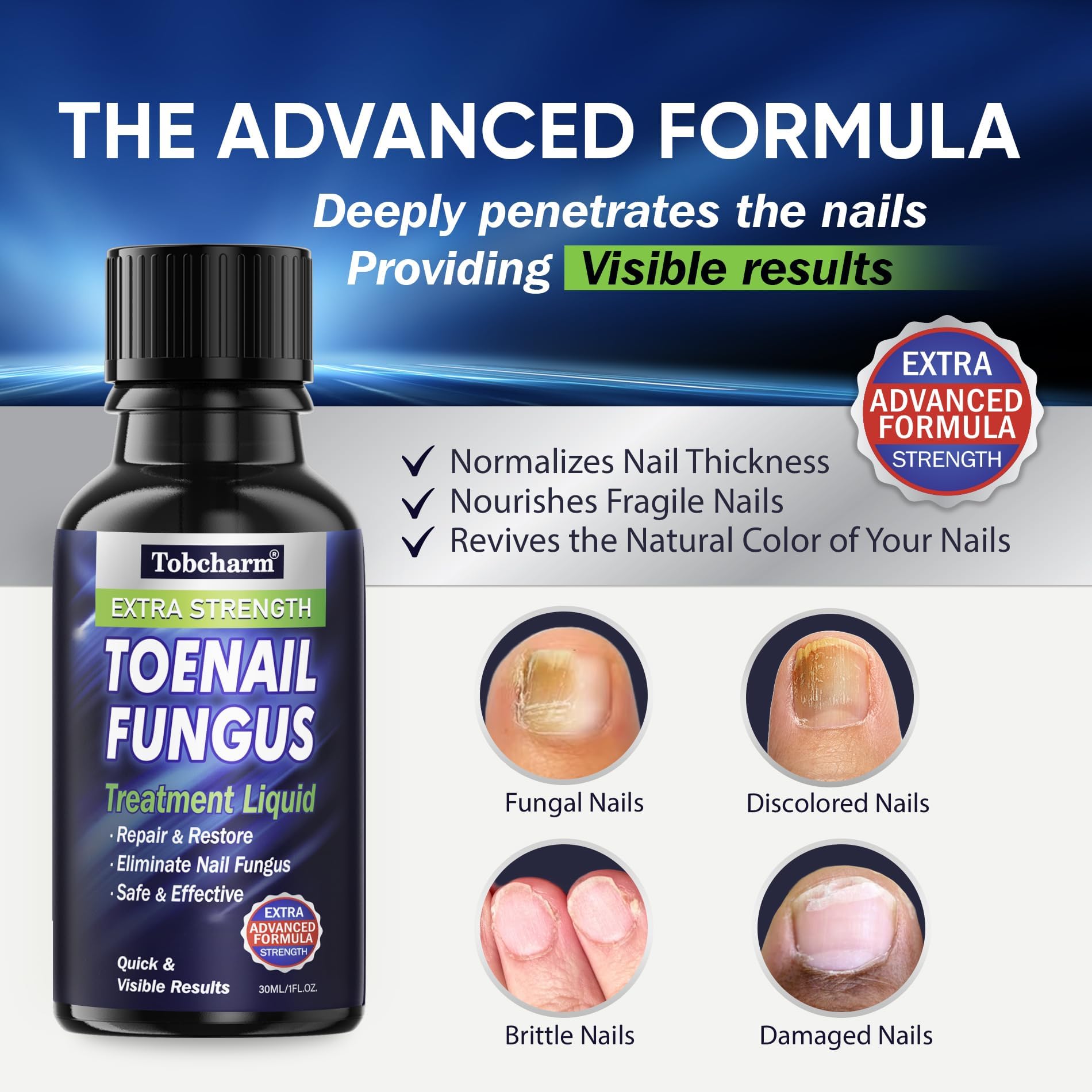 Tobcharm Toenail Fungus Treatment Extra Strength, Nail Fungus Treatment for Toenail, Fungus Nail Treatment, Nail Fungus Treatmen