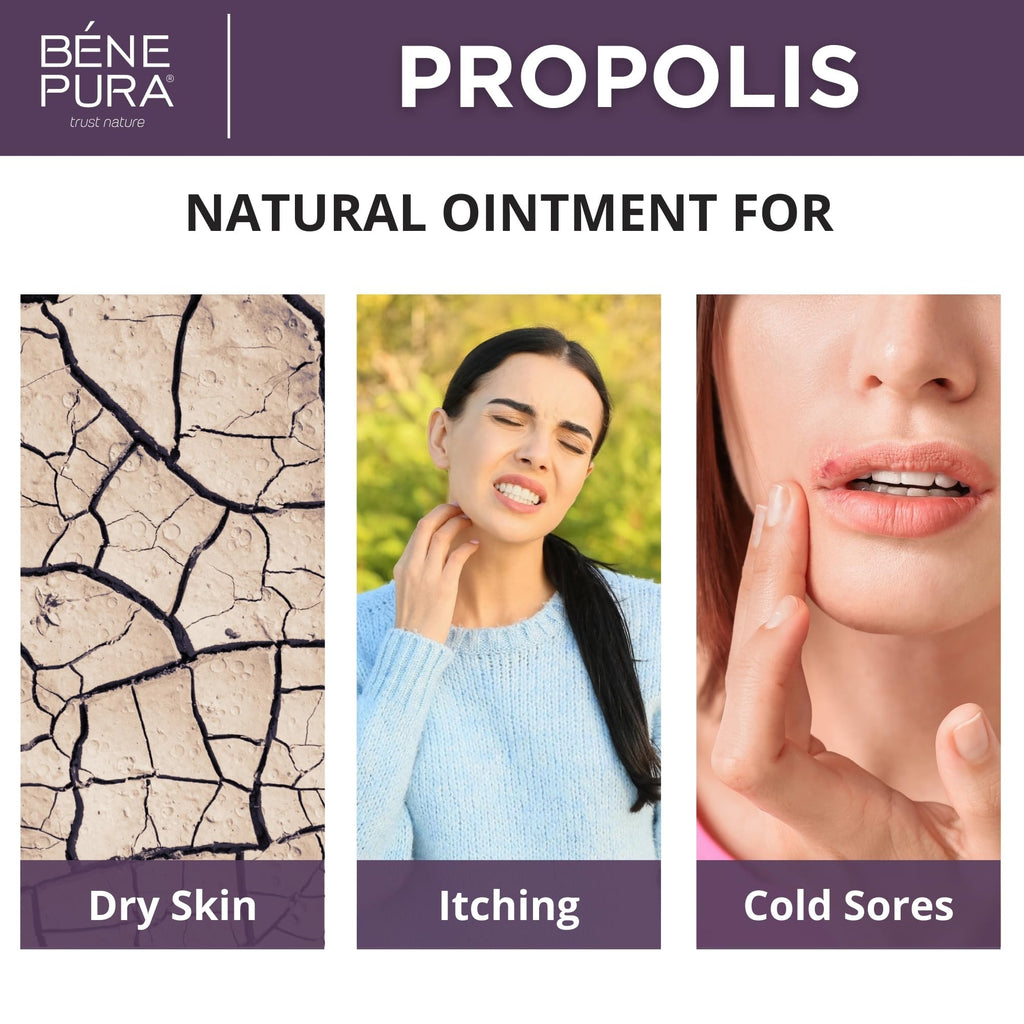 BenePura Propolis Ointment - Natural Anti Itch Cream with 30% Propolis - Itch Relief for Humans, Rash Cream - Multipurpose Moist