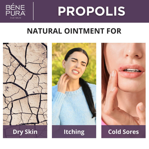 BenePura Propolis Ointment - Natural Anti Itch Cream with 30% Propolis - Itch Relief for Humans, Rash Cream - Multipurpose Moist