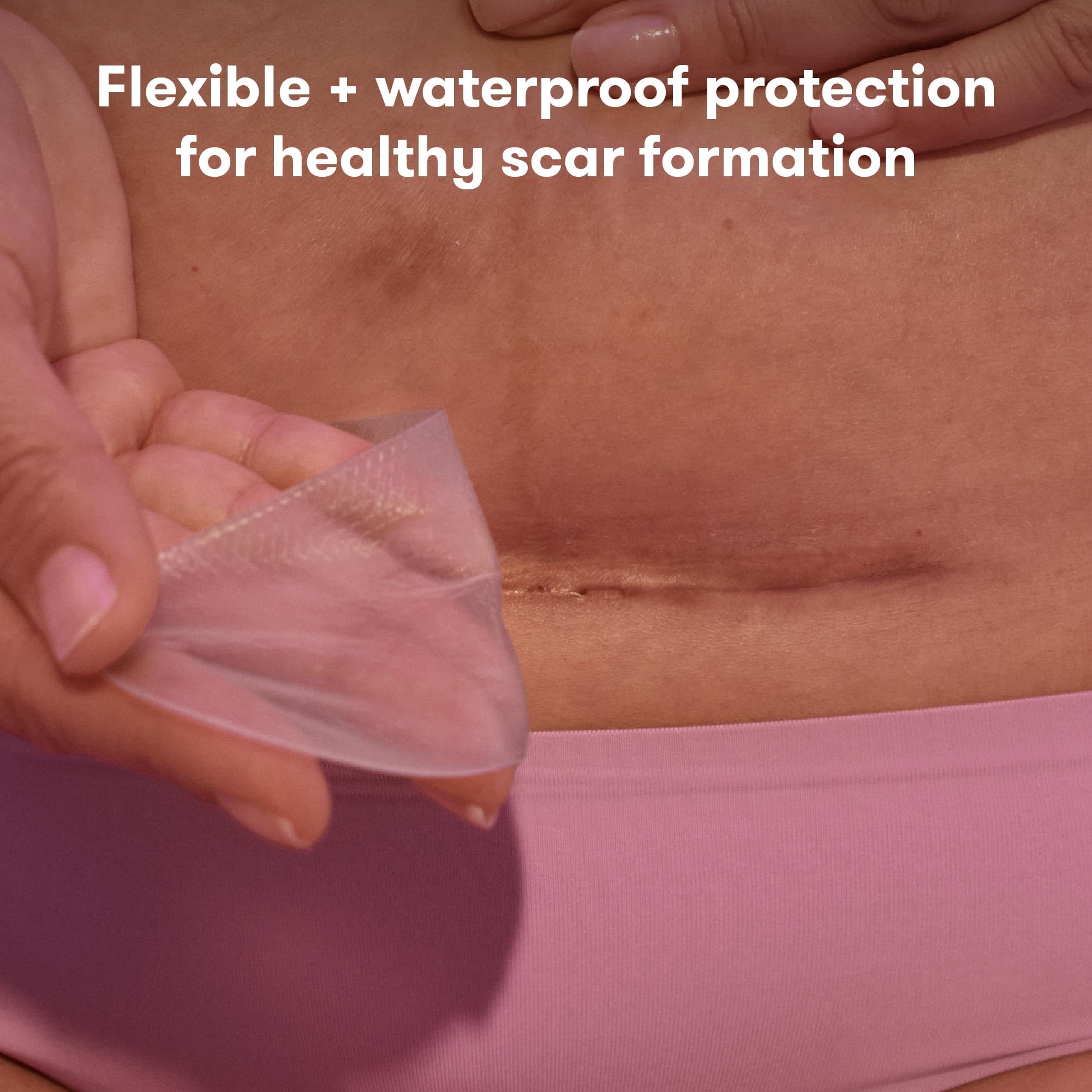 Frida Mom C-Section Silicone Strips, C-Section Recovery Must Have Scar Patches, Reusable Medical Grade Treatment for Keloid Scar
