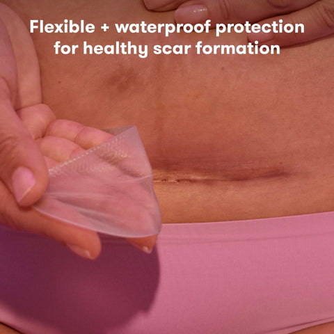 Frida Mom C-Section Silicone Strips, C-Section Recovery Must Have Scar Patches, Reusable Medical Grade Treatment for Keloid Scar