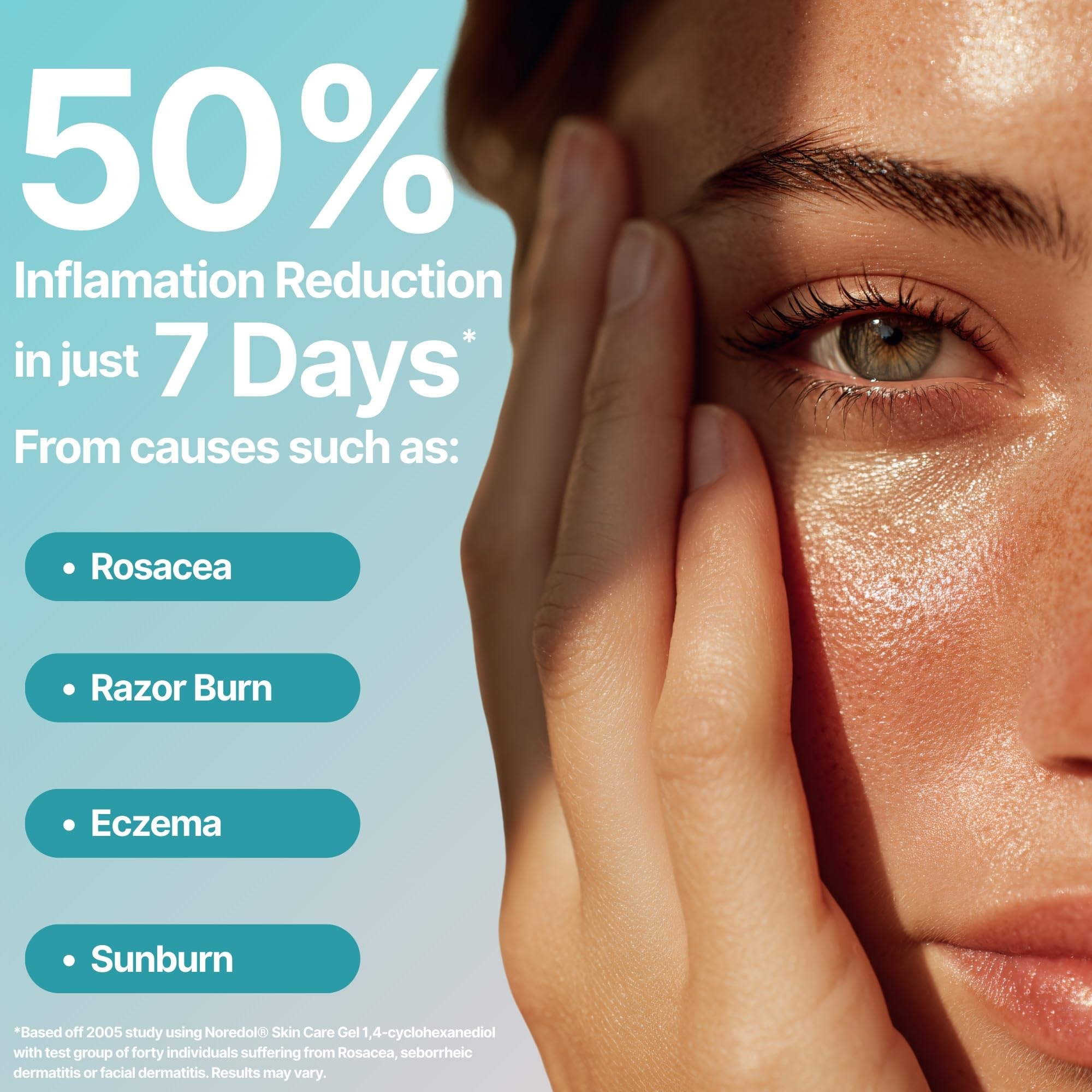 Noredol Skin Care Gel - Redness Relief Moisturizer for Dry Skin - Rosacea Treatment for Face - Soothes Prone Skin and Irritation