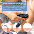 Beurer BR90 Insect Sting and Bite Relief with Light, Chemical-Free Bug Bite Healer for Day and Night, Electronic Heat Device for