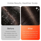 EKZ Sonic Vibrating Scalp Massager Shampoo Brush: Electric Silicone Hair Scrubber for Deep Scalp Clean, Dandruff Removal, Exfoli