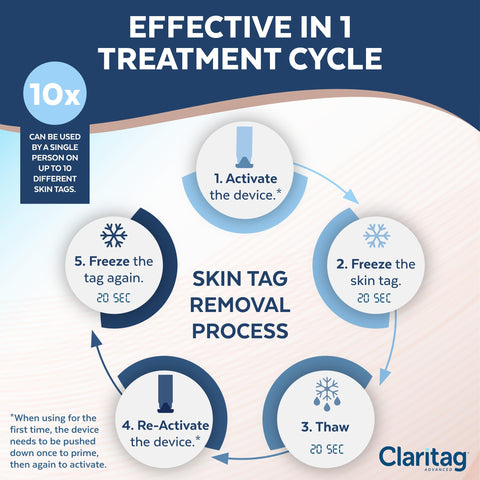 Claritag Advanced Skin Tag Remover - FDA-Cleared Device - Only for Skin Tag Removal - Works in 7-14 Days - Up to 10 Treatment Cy