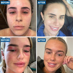 Grahams Natural Face & Eyelid Eczema Cream - Treatment for Eczema, Dermatitis, Itch Relief, Redness, Inflammation & Very Dry Ski