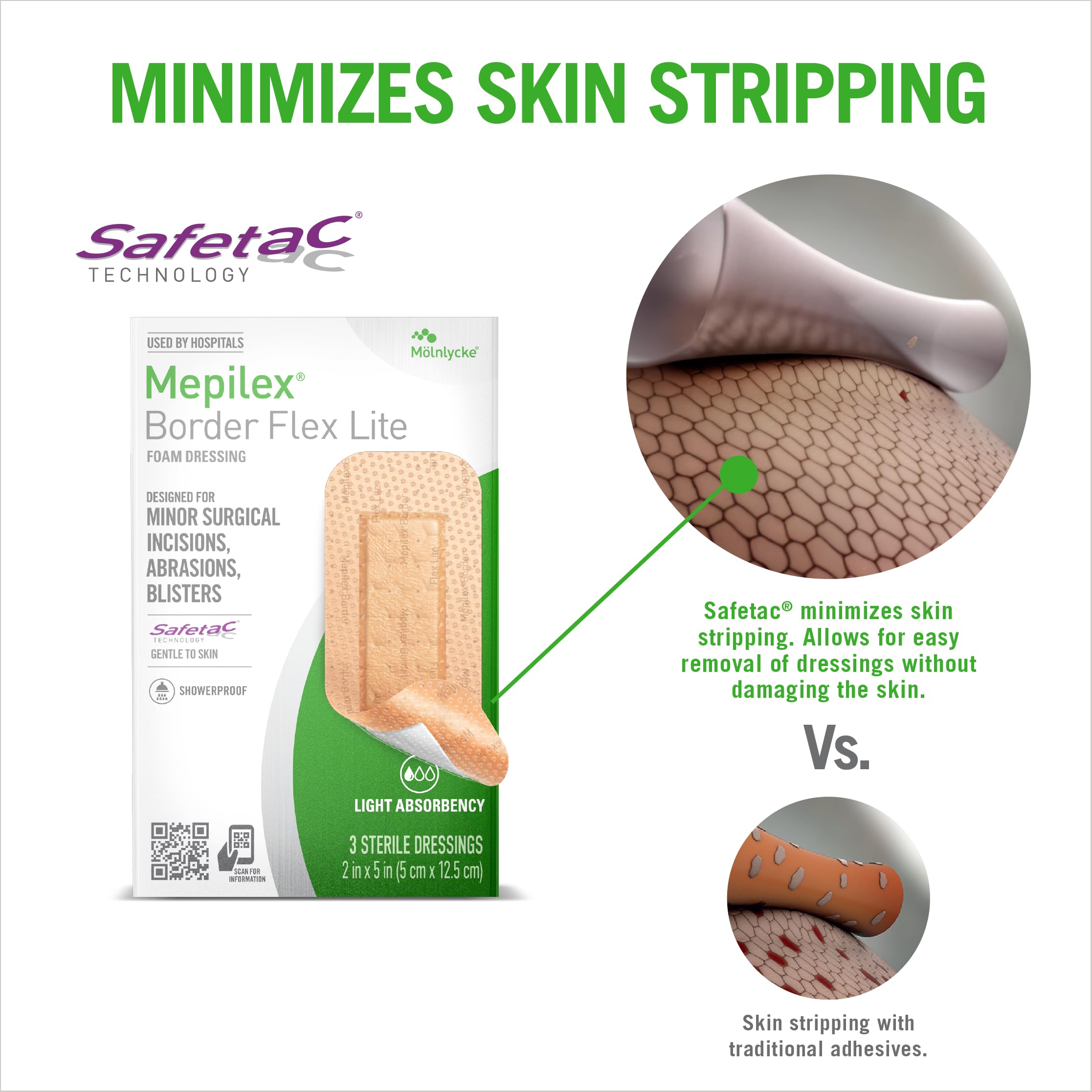 Mepilex Border Flex Lite 2 x 5in (5x12.5 cm) Hospital Grade Dressings for Minor Surgical Incisions, Abrasions and Blisters for u