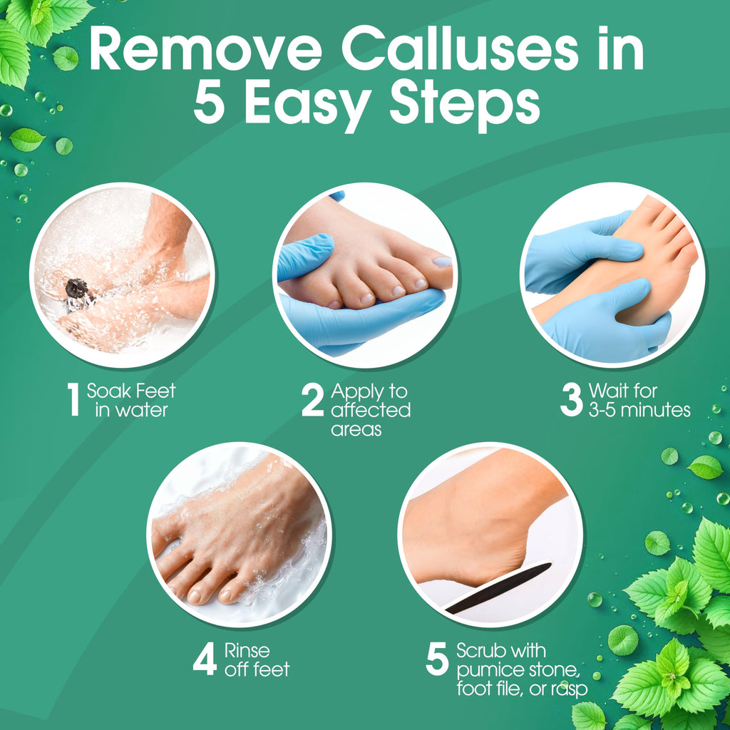 DeEnti Callus Remover for Feet, Extra Strength Foot Callus Remover Gel, 128oz Gallon Salon Grade Bulk Pedicure Supplies for Dry