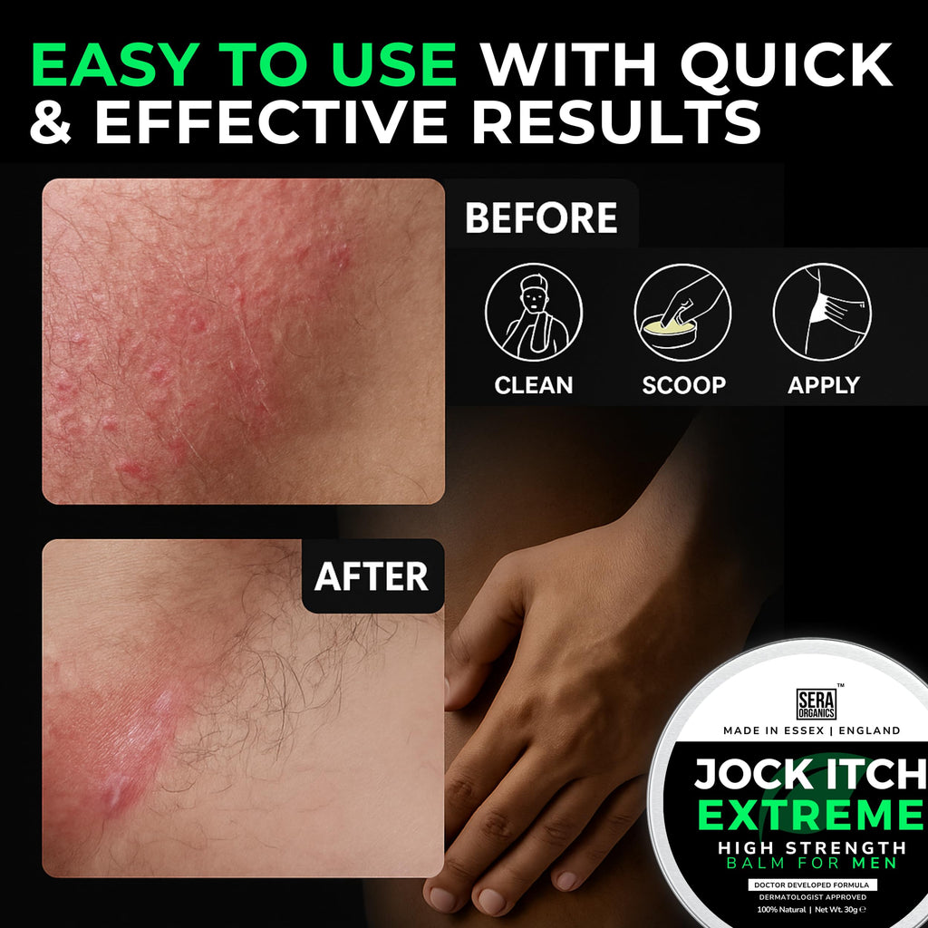Sera Organics Antifungal Cream for Jock Itch Relief - Strong Balm for Mens Groin, Inner Thigh & Sweat Rash | Anti Fungal Skin Cr