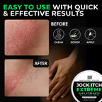 Sera Organics Antifungal Cream for Jock Itch Relief - Strong Balm for Mens Groin, Inner Thigh & Sweat Rash | Anti Fungal Skin Cr