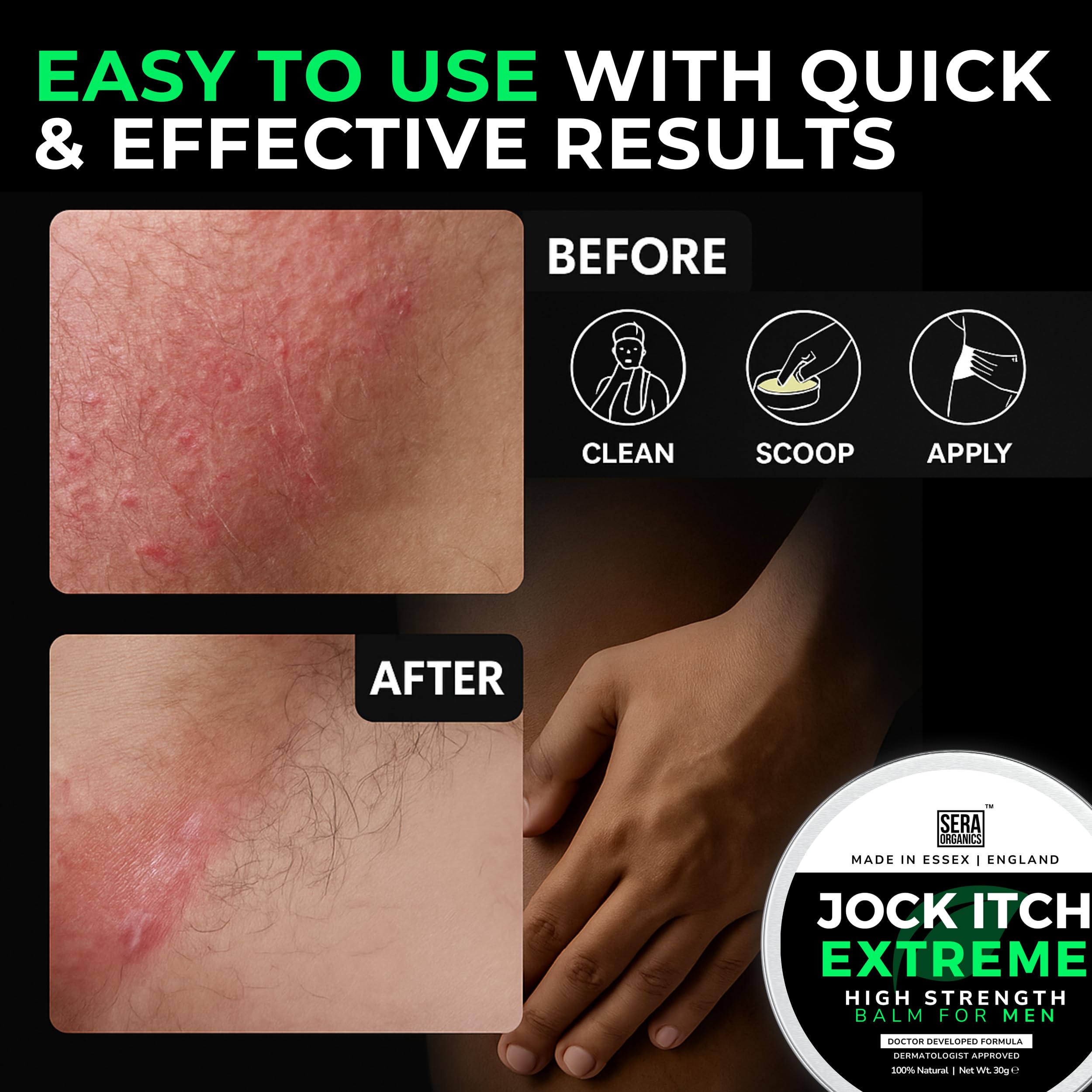 Sera Organics Antifungal Cream for Jock Itch Relief - Strong Balm for Mens Groin, Inner Thigh & Sweat Rash | Anti Fungal Skin Cr