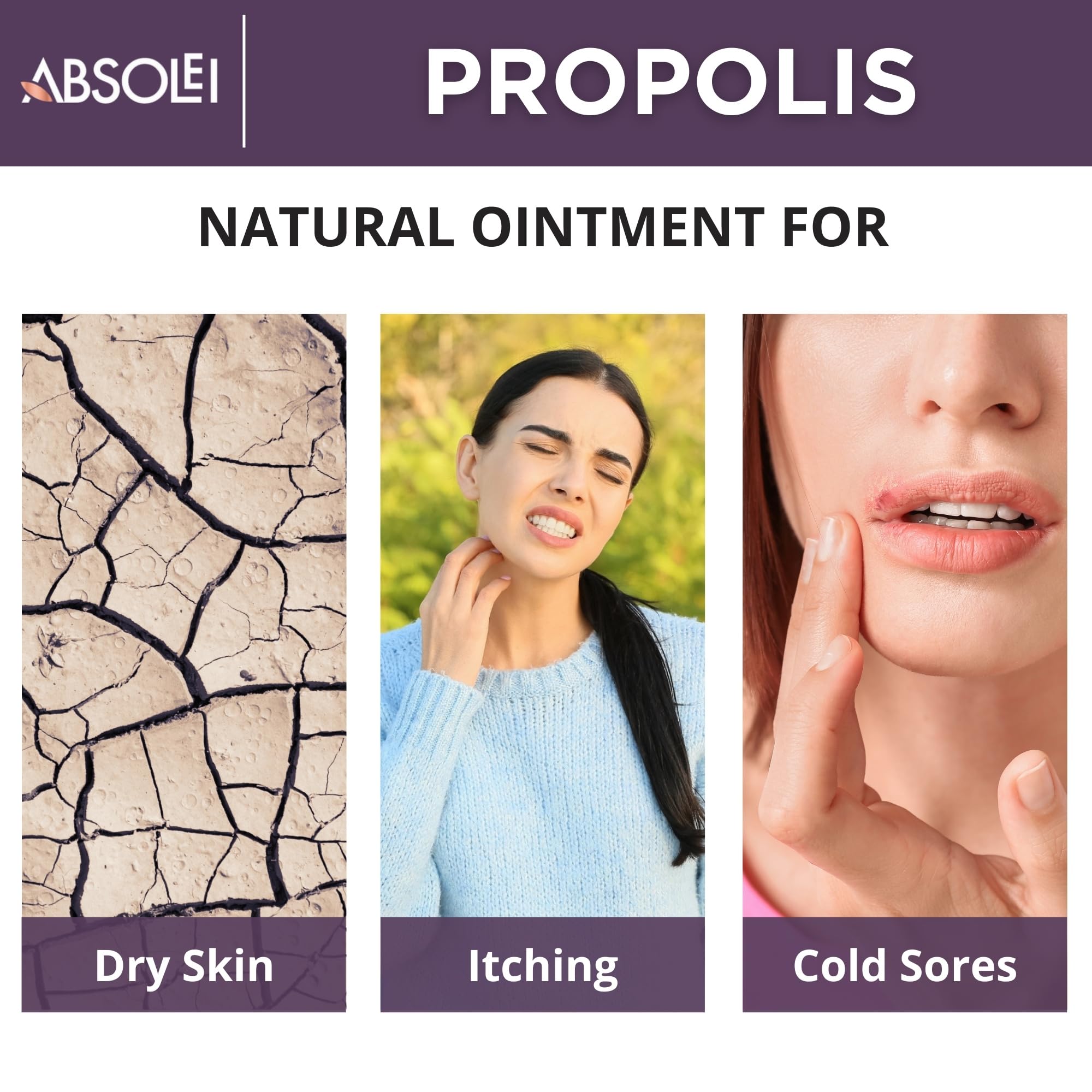 ABSOLEI Propolis Ointment, Natural 30% Propolis Ointment for Itchy, Dry and Cracked Skin, 1.35 fl oz