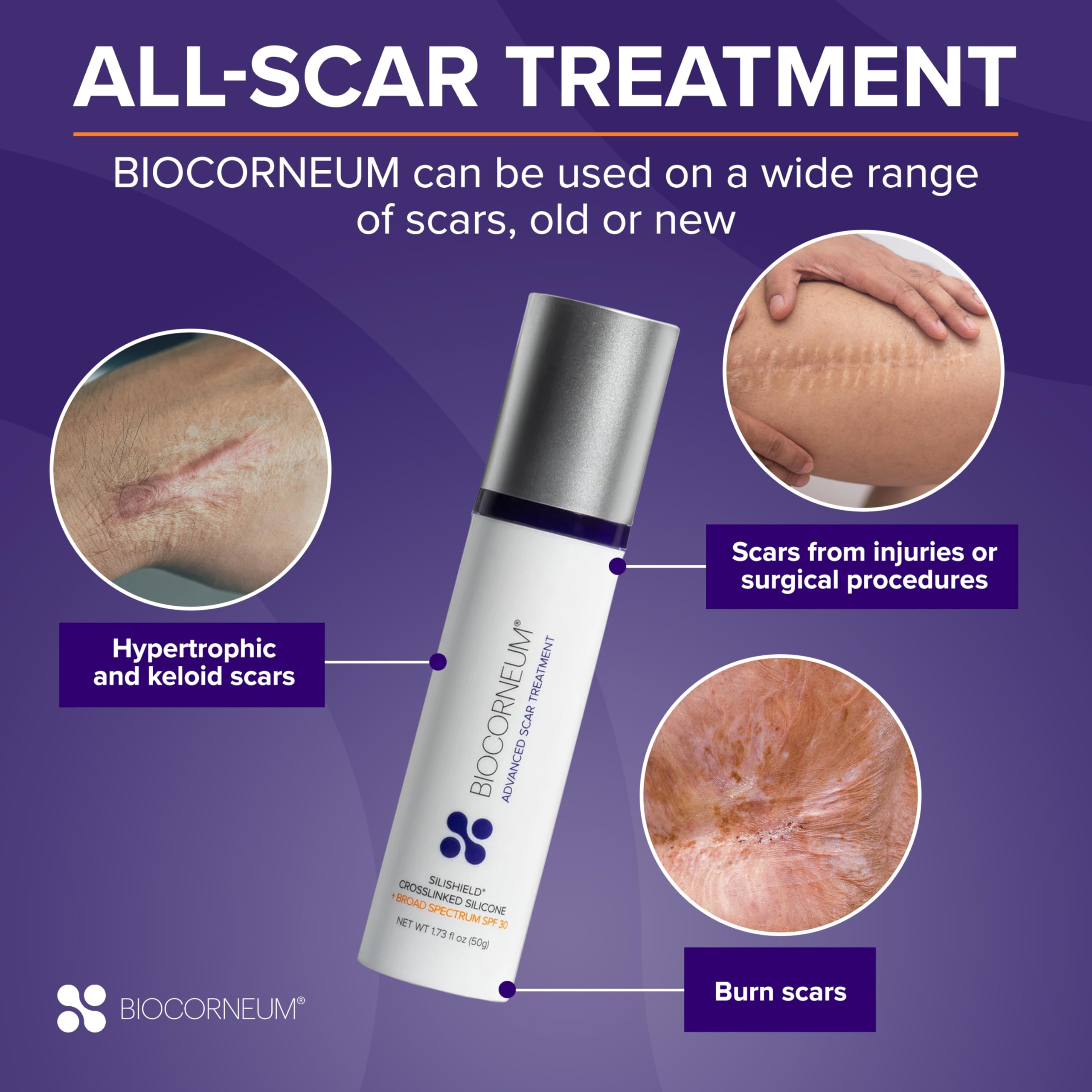 Advanced Scar Treatment with Silishield & SPF 30 50g - Made in the USA, Fast-Drying, Water-Resistant Silicone Scar Gel - Surgeon