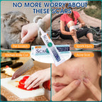 ScarMD Medical Grade Silicone Scar Gel Treatment, Fades Scars from Surgery, C Section, Cuts, Burns and More, Has Naturally Occur