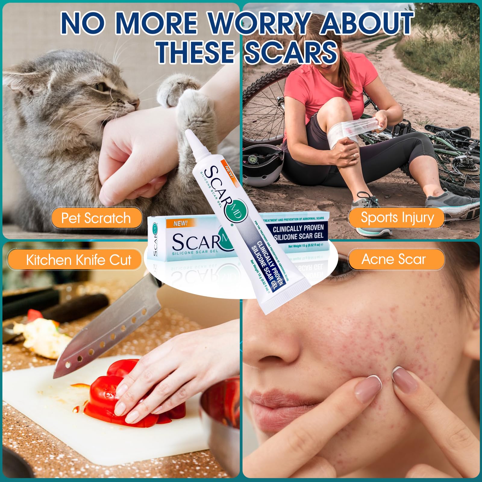 ScarMD Medical Grade Silicone Scar Gel Treatment, Fades Scars from Surgery, C Section, Cuts, Burns and More, Has Naturally Occur