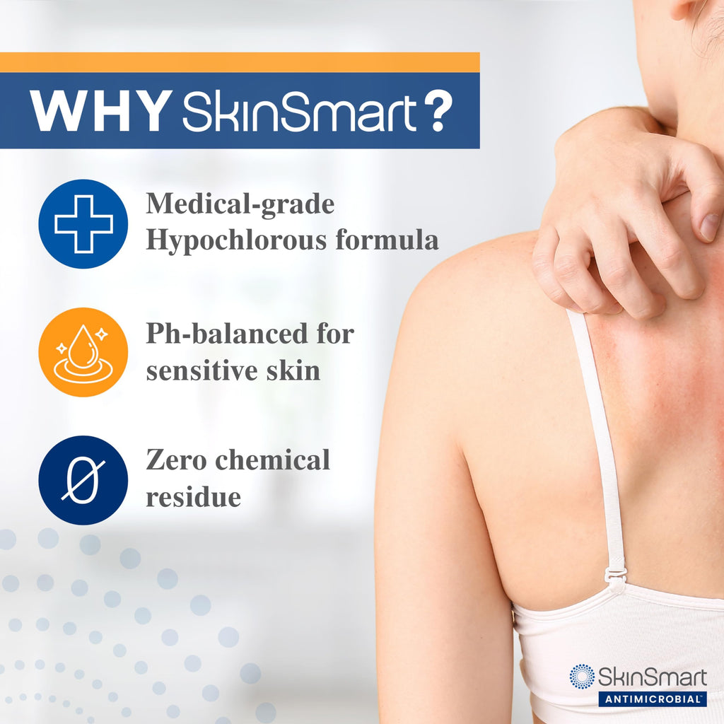 SkinSmart Eczema Therapy, Hypochlorous Antimicrobial Safely Removes Bacteria, so Your Skin Can Heal, Travel Size 2 Ounce Spray (