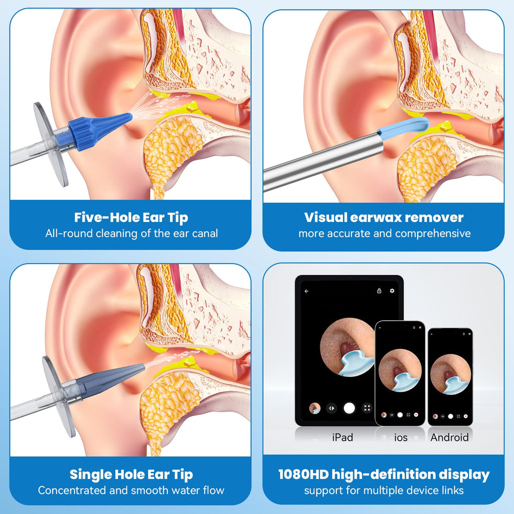 Ear Wax Removal - Ear Cleaner - Ear Camera - FSA HSA Eligible - Ear Wax Removal Kit - Ear Wax Removal Tool Camera - 1080HD Effec