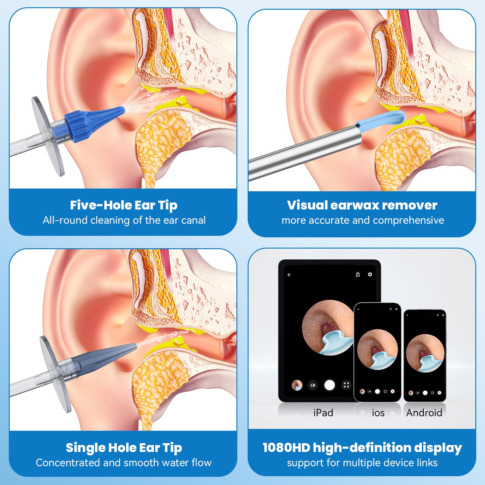 Ear Wax Removal - Ear Cleaner - Ear Camera - FSA HSA Eligible - Ear Wax Removal Kit - Ear Wax Removal Tool Camera - 1080HD Effec