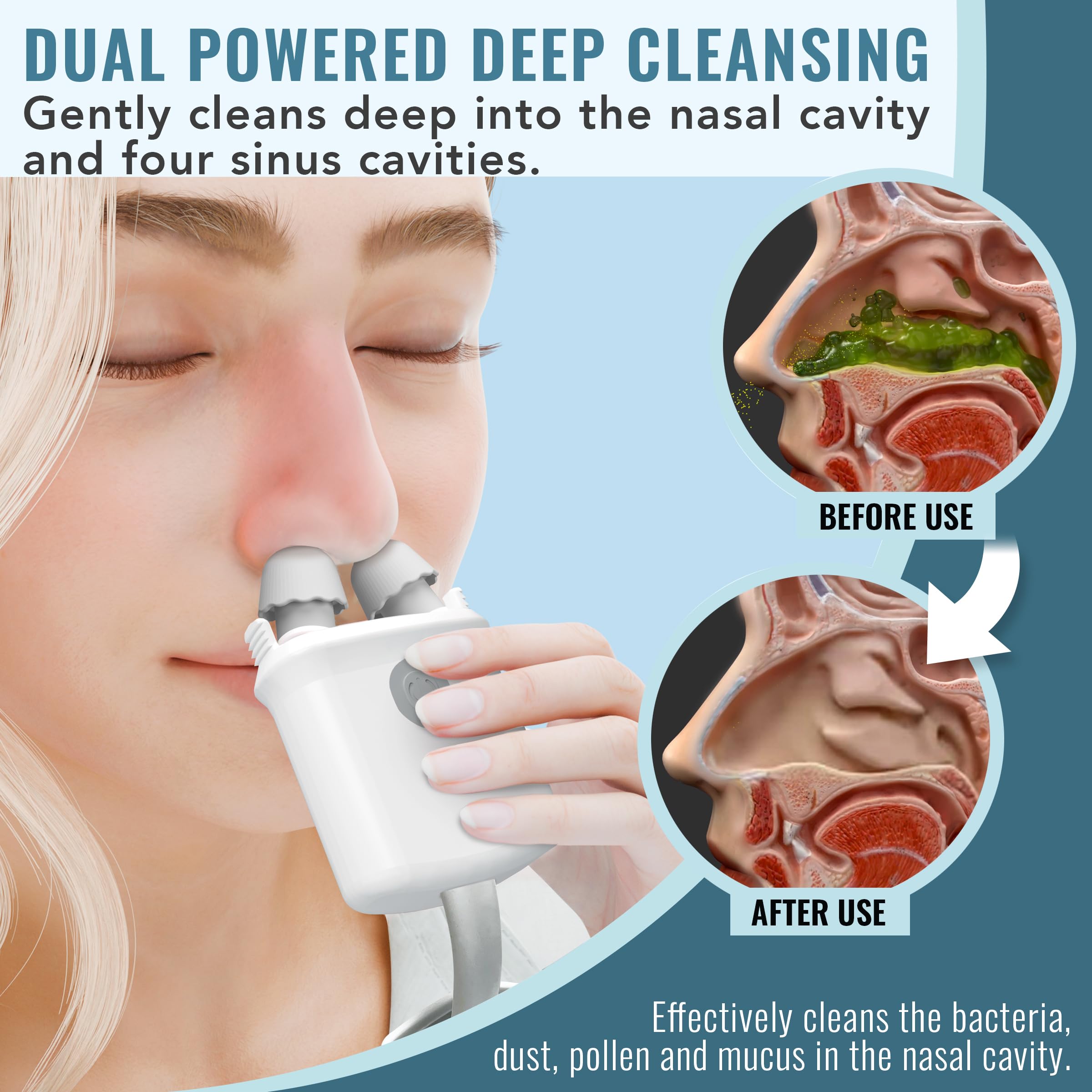 NASALFRESH MD - Dual Powered Nasal Irrigation System Nasal Rinse and Wash - Sinus Decongestant Relief System w/ 30 Saline Packet